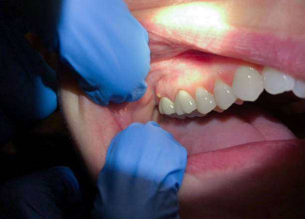 Best Emergency Orthodontic Repairs in Lake Park, GA