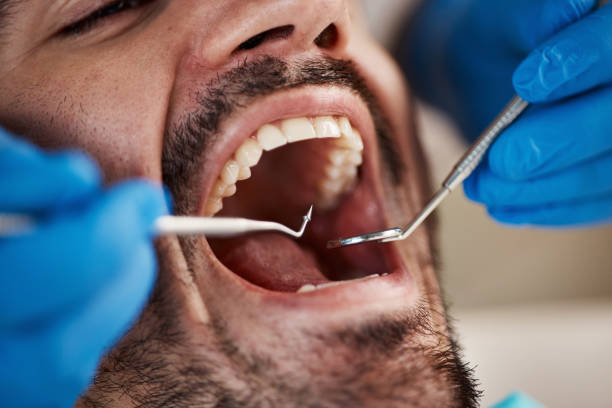 Best Emergency Dental Care for Trauma or Injury in Lake Park, GA