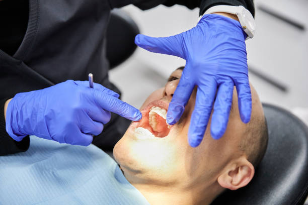 Best Emergency Broken Tooth Repair in Lake Park, GA